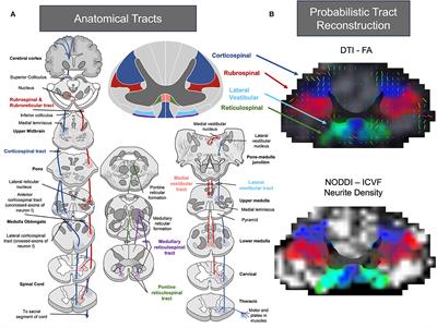 Moving toward elucidating alternative motor pathway structures post-stroke: the value of spinal cord neuroimaging